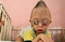 agent orange birth defects 2.jpg